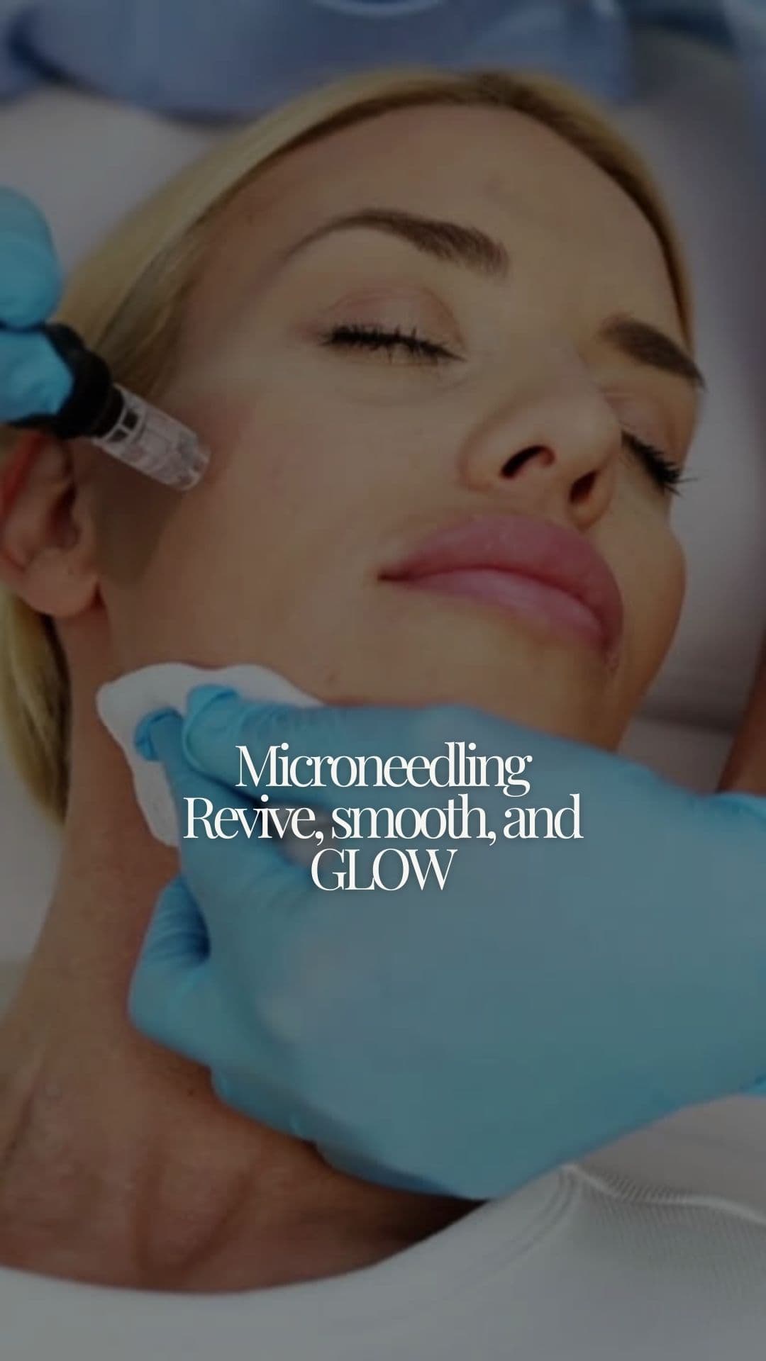 Microneedling Facial